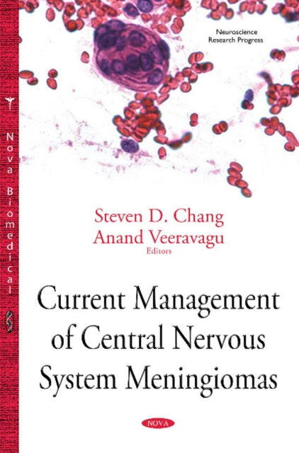 Current Management of Central Nervous System Meningiomas