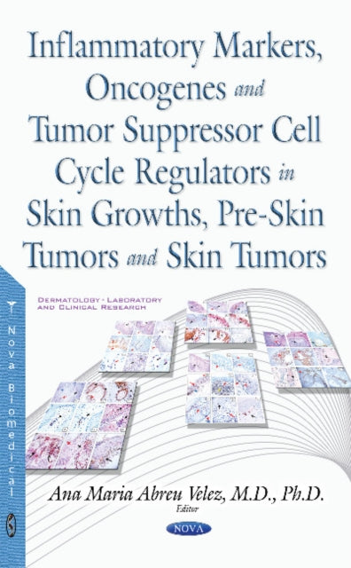 Inflammatory Markers, Oncogenes, Tumor Suppressor