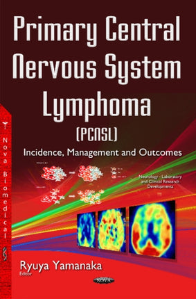 Primary Central Nervous System Lymphoma (PCNSL):
