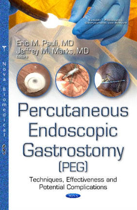 Percutanous Endoscopic Gastrostomy (PEG):