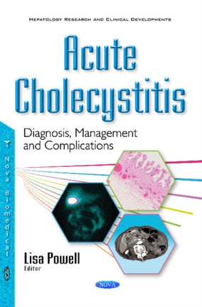 Acute Cholecystitis: Diagnosis, Management & Complications