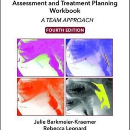 Dysphagia Assessment and Treatment Planning