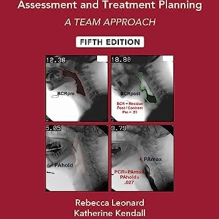 Dysphagia Assessment and Treatment Planning: A Team Approach: 2025