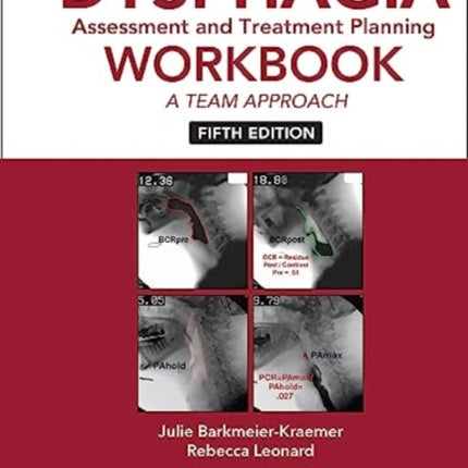 Dysphagia Assessment and Treatment Planning Workbook: A Team Approach: 2025