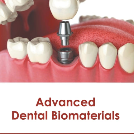 Advanced Dental Biomaterials