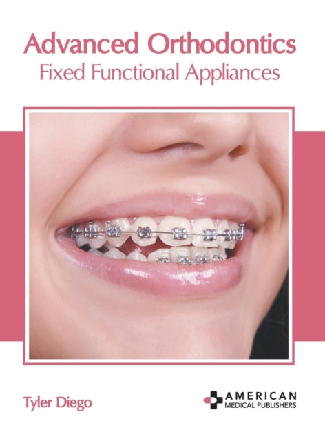 Advanced Orthodontics: Fixed Functional Appliances