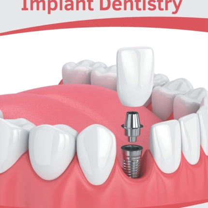 Clinical Advances in Implant Dentistry