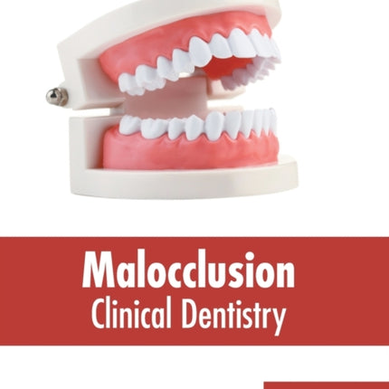 Malocclusion: Clinical Dentistry