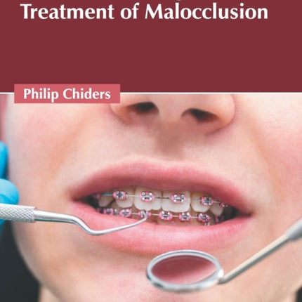 Orthodontic Diagnosis and Treatment of Malocclusion