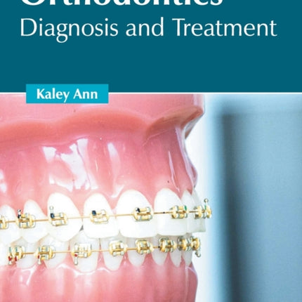 Orthodontics: Diagnosis and Treatment