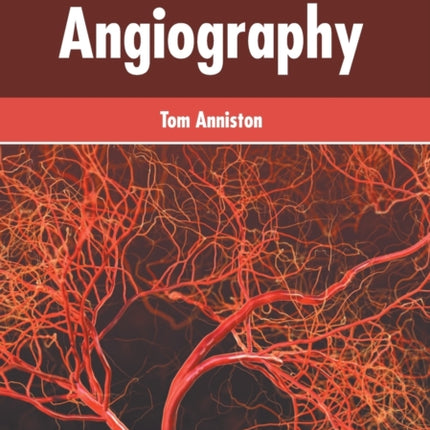 Handbook of Angiography