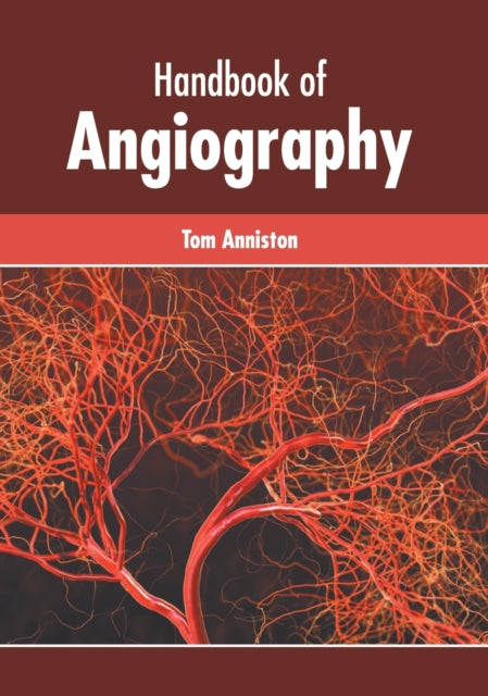 Handbook of Angiography