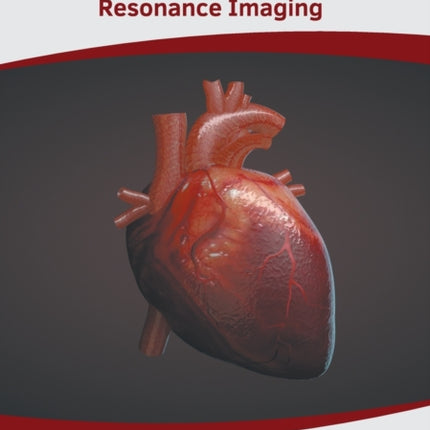 Handbook of Cardiovascular Magnetic Resonance Imaging