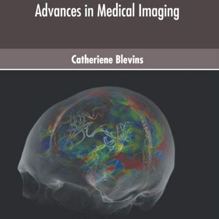 Pet and Spect Imaging: Advances in Medical Imaging