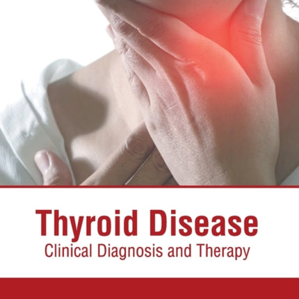 Thyroid Disease: Clinical Diagnosis and Therapy