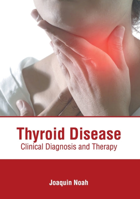 Thyroid Disease: Clinical Diagnosis and Therapy