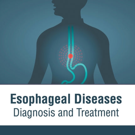 Esophageal Diseases: Diagnosis and Treatment