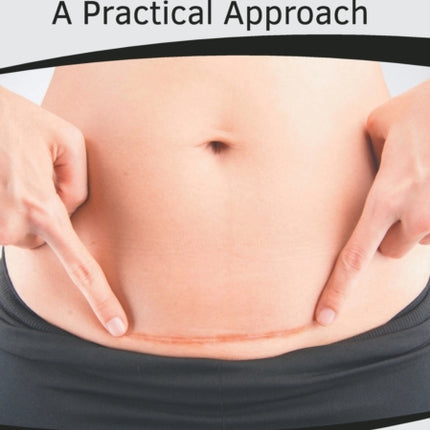 Cesarean Delivery: A Practical Approach