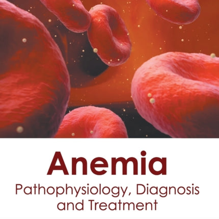 Anemia: Pathophysiology, Diagnosis and Treatment