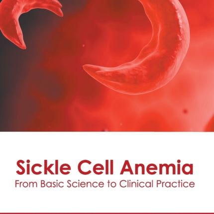 Sickle Cell Anemia: From Basic Science to Clinical Practice