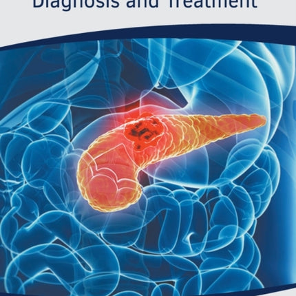 Pancreatic Diseases: Diagnosis and Treatment