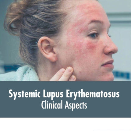 Systemic Lupus Erythematosus: Clinical Aspects