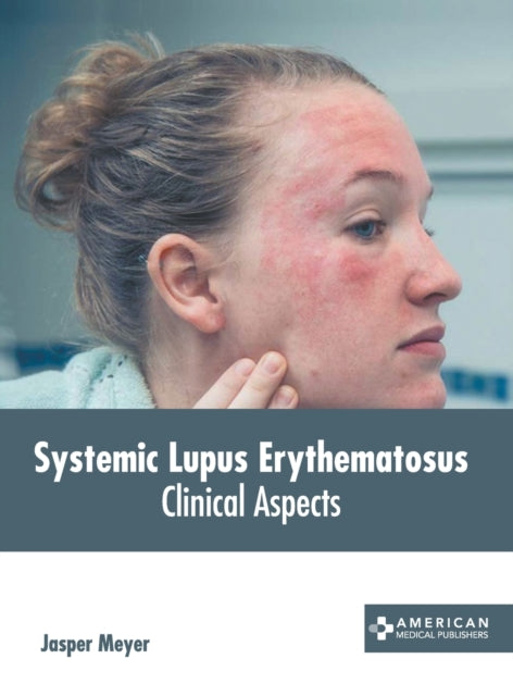 Systemic Lupus Erythematosus: Clinical Aspects