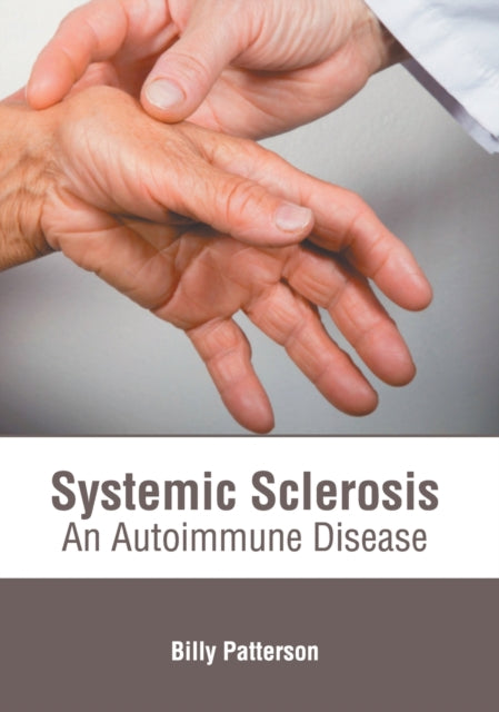 Systemic Sclerosis: An Autoimmune Disease