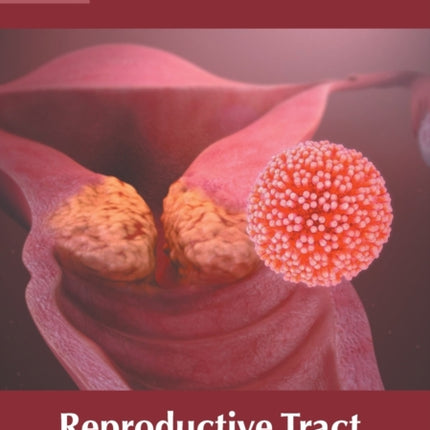 Reproductive Tract Infections