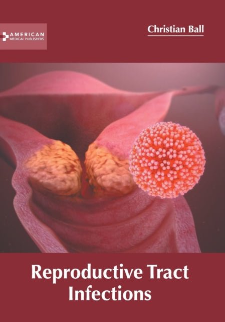 Reproductive Tract Infections