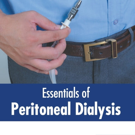 Essentials of Peritoneal Dialysis