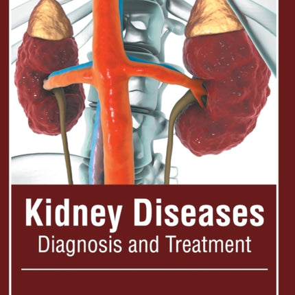 Kidney Diseases: Diagnosis and Treatment