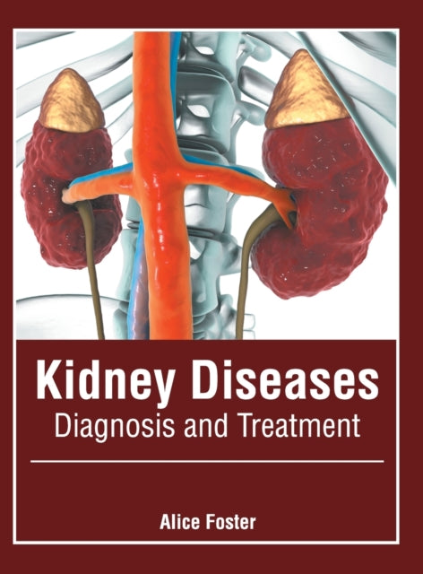 Kidney Diseases: Diagnosis and Treatment