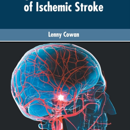 Diagnosis and Treatment of Ischemic Stroke