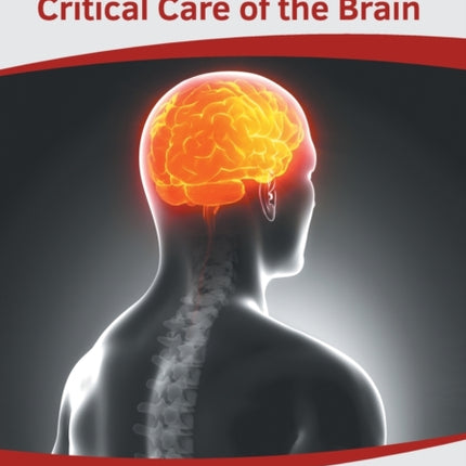 Neurotrauma and Critical Care of the Brain