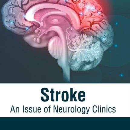 Stroke: An Issue of Neurology Clinics