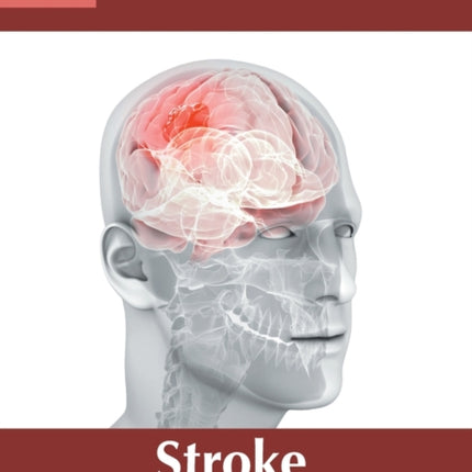 Stroke: Pathophysiology, Diagnosis and Management