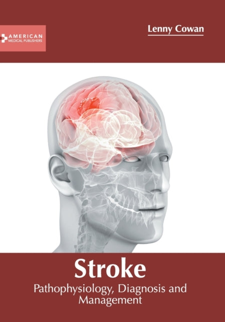 Stroke: Pathophysiology, Diagnosis and Management