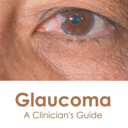 Glaucoma: A Clinician's Guide