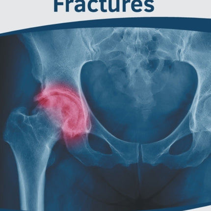 A Clinical Approach to Fractures