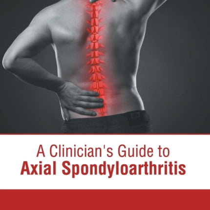 A Clinician's Guide to Axial Spondyloarthritis