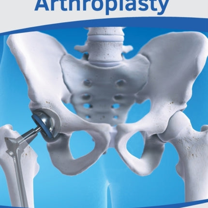 Clinical Advances in Arthroplasty