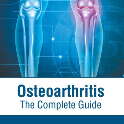 Osteoarthritis: The Complete Guide