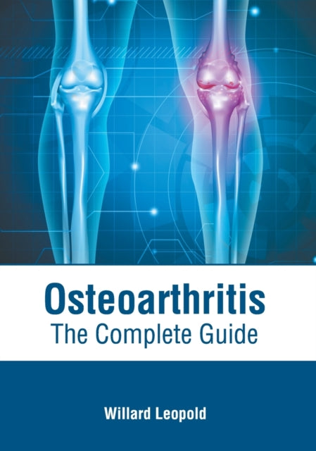 Osteoarthritis: The Complete Guide