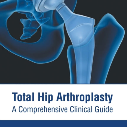 Total Hip Arthroplasty: A Comprehensive Clinical Guide