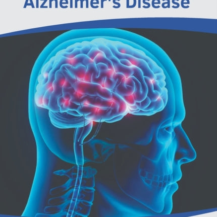 A Clinician's Guide to Alzheimer's Disease