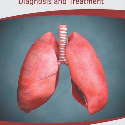 Pulmonary Diseases: Diagnosis and Treatment