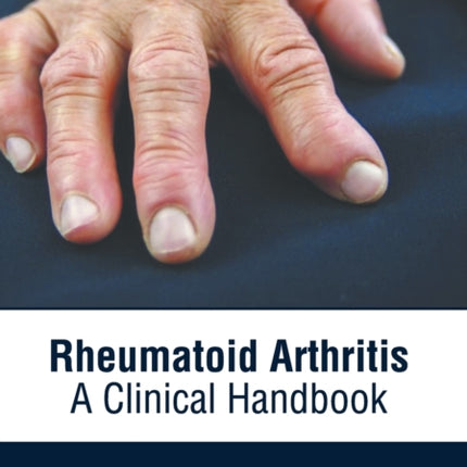 Rheumatoid Arthritis: A Clinical Handbook