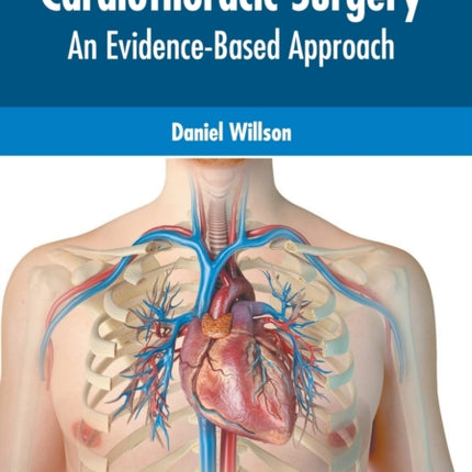 Cardiothoracic Surgery: An Evidence-Based Approach