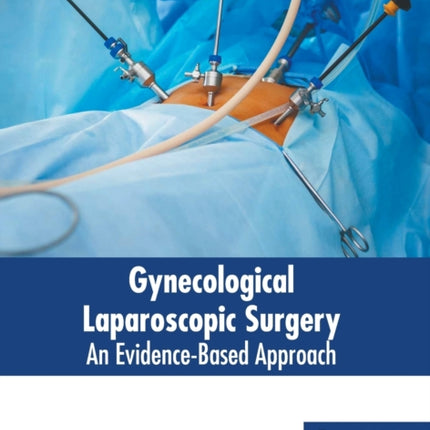 Gynecological Laparoscopic Surgery: An Evidence-Based Approach